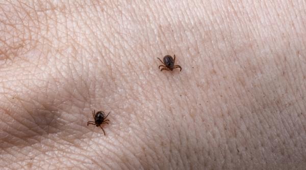 ce trebuie sa faci dupa ce te a muscat o capusa dr carmen dorobat primele masuri