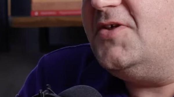 procedura controversata pentru dinti dr grozescu uita te la dintii mei sunt varza dar sunt ai mei mi se pare o prostie sa faci o asemenea interventie