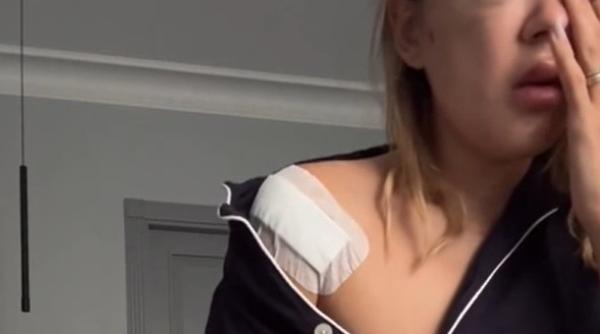 emily burghelea desfigurata dupa un accident de masina in vacanta video