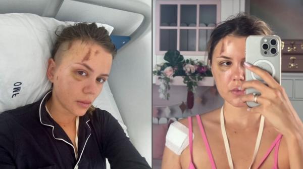 emily burghelea bagata urgent in operatie dupa accident ma gandesc la orice