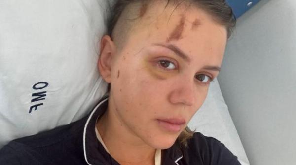 in ce stare se afla emily burghelea a suferit prima operatie dupa accident simt fierul din cap cum se misca