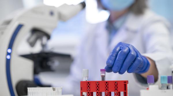 sanatatea tiroidei ce inseamna daca ne iese atpo mare cum scadem nivelul