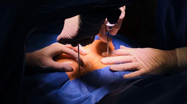 biopsia de maduva osoasa cand e recomandata