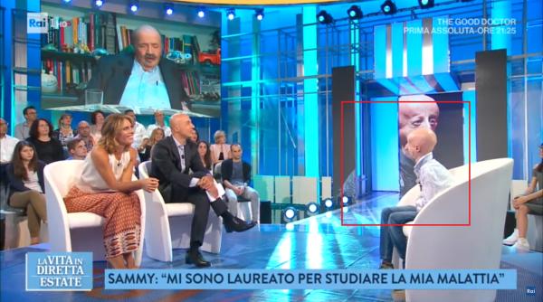 a murit sammy basso cel mai longeviv pacient diagnosticat cu progerie avea doar 28 de ani