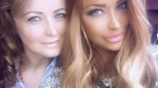 bianca dragusanu si a convins mama sa si puna acid in buze pentru a treia oara o duc la botox o fac si mai frumoasa
