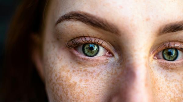 ai o pata noua pe piele afla daca e pistrui pata solara sau alunita si cand trebuie sa mergi urgent la medic