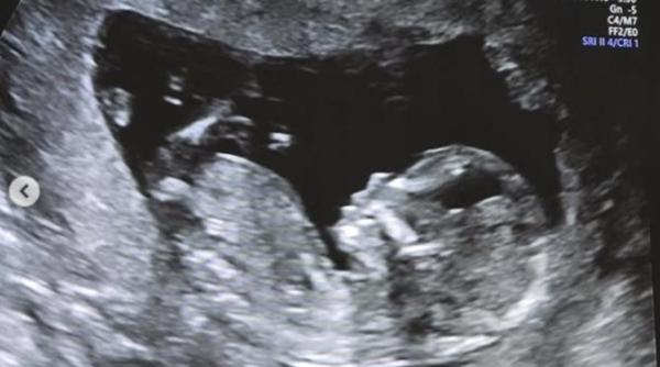 ilona brezoianu este insarcinata primele imagini si mesajul coplesitor al lui capet mi au tasnit instant lacrimile