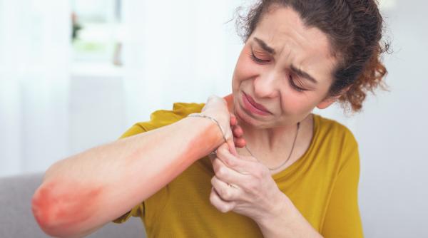 aveti alergii alimentare iata 8 sfaturi care va ajuta sa fiti in siguranta cand calatoriti