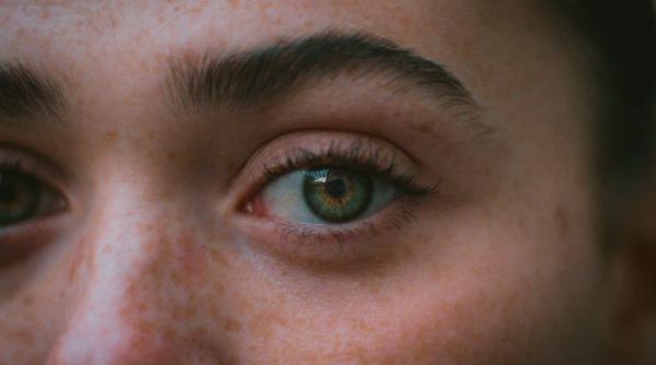 poti scapa de petele intunecate de pe ten mit sau problema tratabila mirela vescan si thea haimovitz iti spun cum sta treaba video