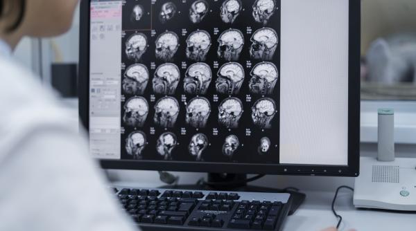 alimentele care favorizeaza aparitia bolii parkinson ce trebuie sa eviti