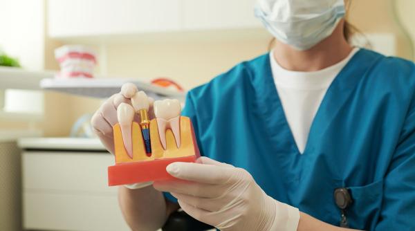 contraindicatii implant dentar afla care sunt acestea