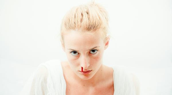 de ce nu trebuie sa lasam capul pe spate atunci cand ne curge sange din nas explicatia unui chirurg