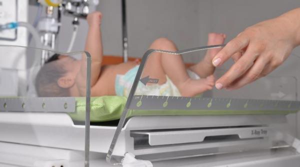 o femeie nascuta fara creier sfideaza previziunile medicilor si isi sarbatoreste cea de a 20 a aniversare