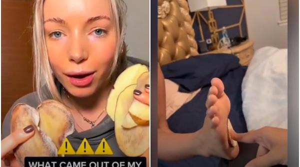 trend viral pe tiktok de ce isi pun influencerii felii crude de cartof in sosete inainte de culcare