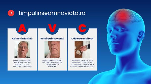 avc ul nu tine cont de varsta cum iti protejezi creierul de accidentul vascular cerebral
