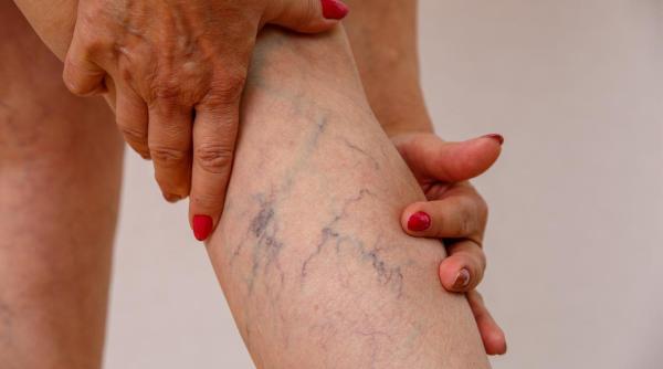 semnele bolii care afecteaza 80 dintre romani cand trebuie sa te adresezi medicului dr toni feodor 4 milioane de romani au aceasta boala