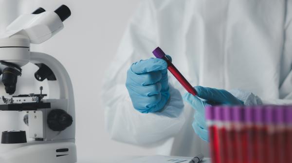 cnas pregateste eliminarea plafoanelor pentru analizele de laborator ce trebuie sa stie romanii video