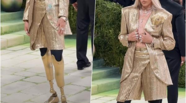 povestea fetei cu picioarele de aur de la met gala 2026 si a pierdut ambele picioare dupa ce un tampon i a provocat o afectiune rara