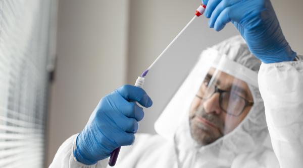 zeci de cazuri de infectie cu hantavirus anual intr o tara de la granita romaniei oamenii sunt sfatuiti sa nu mature spatiile in care pot exista rozatoare