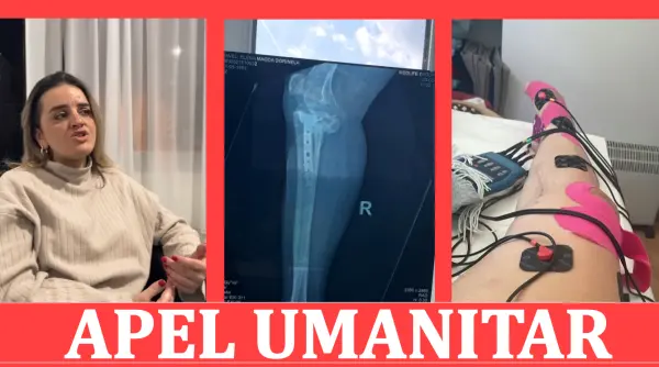 apel umanitar elena are nevoie de ajutor ca sa se opereze in italia pentru a putea sa mearga din nou