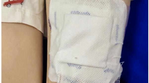 copil de 6 ani gasit in coma dupa ce sora lui i a pus plasturi cu fentanil pe o rana dr radu tincu substanta e mai puternica decat morfina