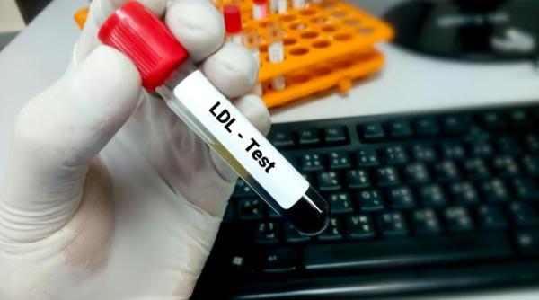 provocarea 50 2030 colesterol sub control noua campanie lansata in lupta contra colesterolului de ziua mondiala a inimii