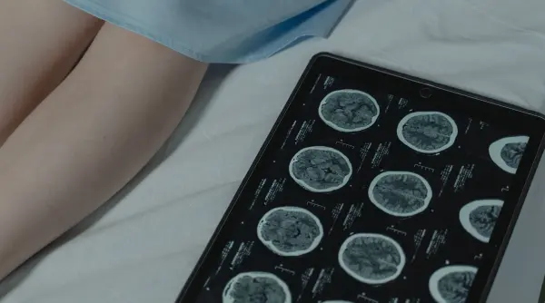 nu vreau sa fim singuri prof univ dr craiu medic primar neuropsihiatrie pediatrica semnal de alarma in epilepsiile rare video