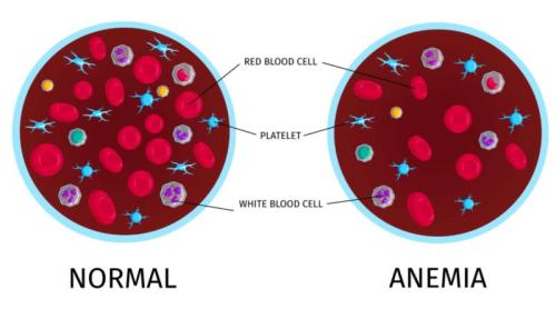 De ce apare anemia? Cercetătorii au identificat un hormon care „frânează” formarea globulelor roșii