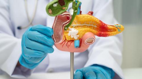 Un nou medicament aproape dublează supraviețuirea pacienților cu cancer pancreatic metastatic