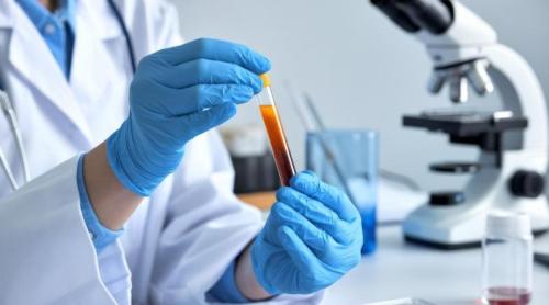Ce înseamnă hemoglobină mică. De ce nu este întotdeauna vorba despre lipsa de fier