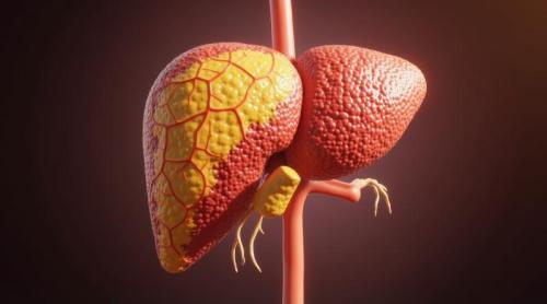 Un medicament experimental a inversat formele severe de ficat gras și a reparat intestinul