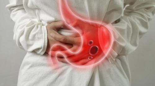 10 medicamente care pot provoca arsuri la stomac. Unele sunt luate zilnic de milioane de oameni