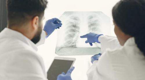 Cancer pulmonar fără să fi fumat vreodată. De ce sunt din ce în ce mai multe cazuri?