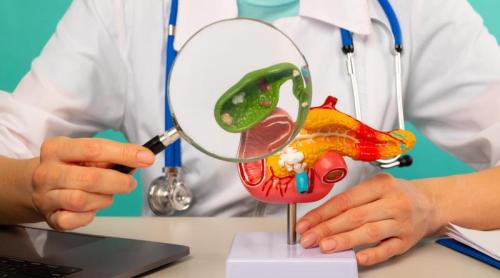 Care este legătura dintre cancerul pancreatic și colesterol