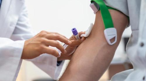Ce analize simple trebuie să faci ca să descoperi din timp boala renală cronică 