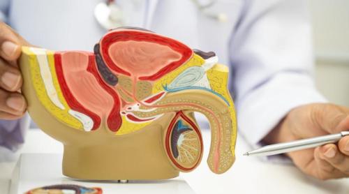 Ce legătură există între cancerul de prostată și colesterol