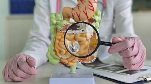 Ce trebuie să mănânci DUPĂ cancerul de colon? Dieta simplă care reduce riscul de deces cu 87%