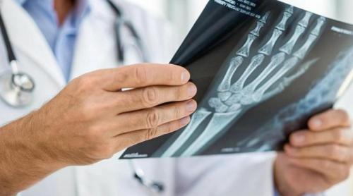 Ora la care mănânci ar putea influența oasele după vârsta de 50 de ani