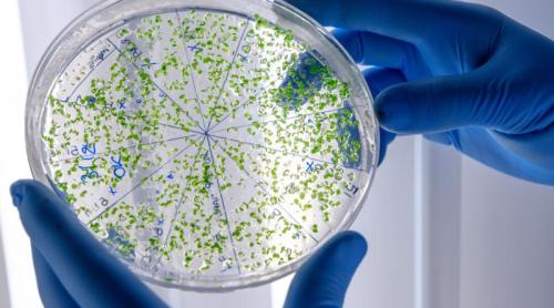 Salmonella nu îi îmbolnăvește pe toți la fel. Când rămâne în intestin și când ajunge în sânge?