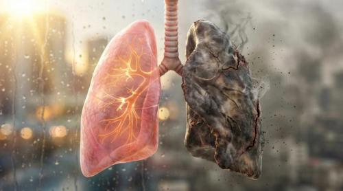 Semnul banal al cancerului pulmonar. Când trebuie să mergi la medic