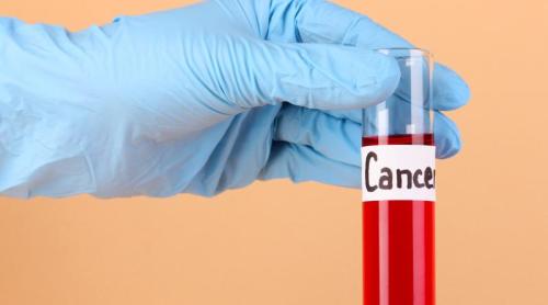 Testul de sânge care poate depista din timp recidiva cancerului