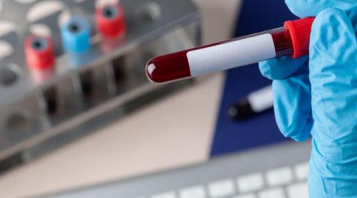 Testul de sânge care poate indica un risc mai mare de cancer, cu ani înainte de diagnostic