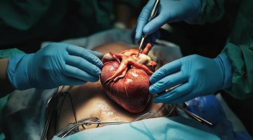 Transplantul de inimă, „citit” la nivel molecular. Cercetătorii au descoperit programe celulare ascunse în respingerea organului