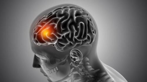 AVC ul nu înseamnă sfârșitul drumului: ce se întâmplă în creier după un accident vascular cerebral