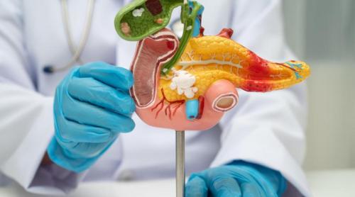 Descoperire majoră în cancerul pancreatic. Boala, identificată înaintea simptomelor