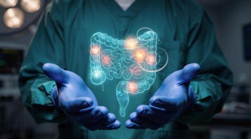 O formă de cancer colorectal poate răspunde mai slab la chimioterapie. Ce se întâmplă când ajunge la ovare