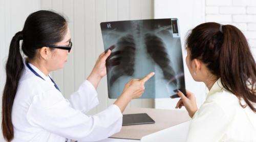 Respirăm plastic? Microplasticele găsite în plămânii pacienților cu cancer pulmonar ridică semne de întrebare