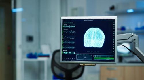 Robotul nu operează singur. Ce poate face și ce nu poate face în neurochirurgie
