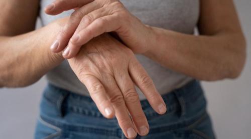Un medicament experimental ar putea ajuta milioane de femei care se confruntă cu osteoporoza