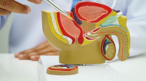Adenomul de prostată, operat fără incizii la Fundeni. Dr. Mihai Dobra explică noua tehnică HoLEP, cu laser de mare putere